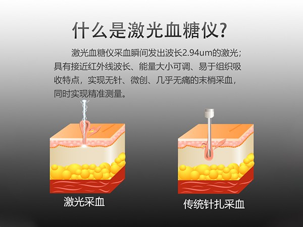 白色款激光血糖仪